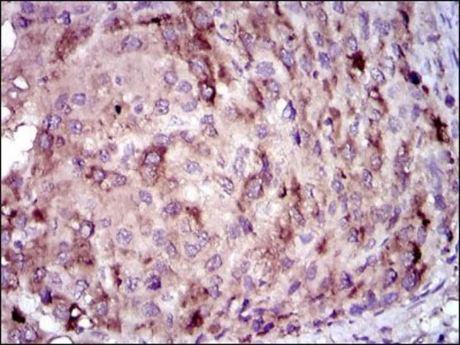 抗C反应蛋白抗体-Antibody-免疫组织化学(IHC)